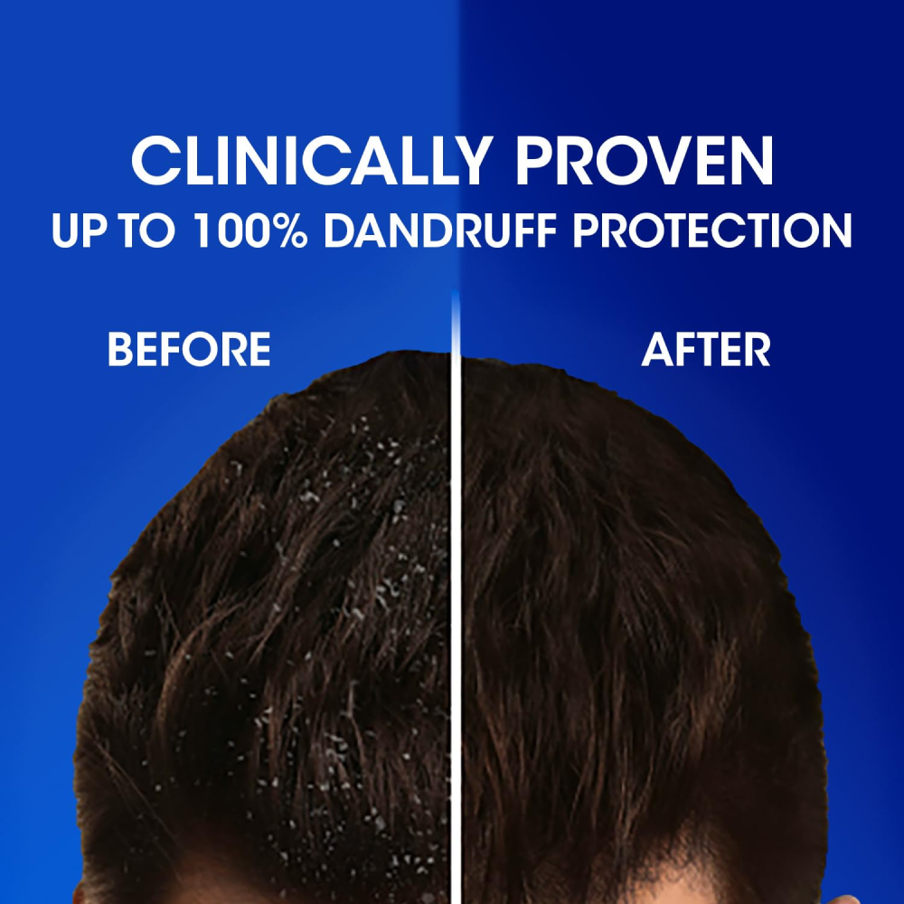 HEAD & SHOULDERS Cool Menthol Anti-Dandruff Shampoo for Scalp Protection